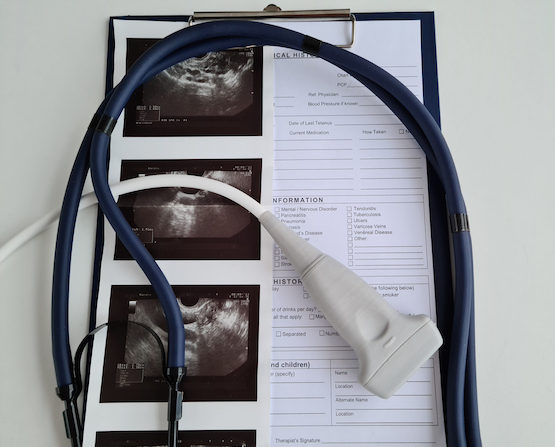 Ultrasound organs stethoscope medical card. Gynecology and early diagnosis of pregnancy