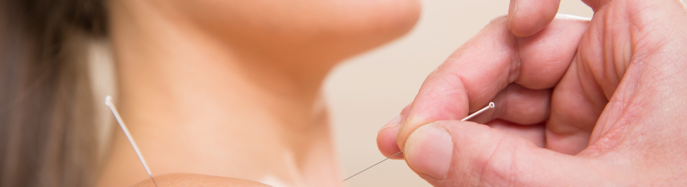 Dry Needling, Acupuncture & Exercise for Adhesive Capsulitis Evidence